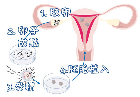 代生包男宝